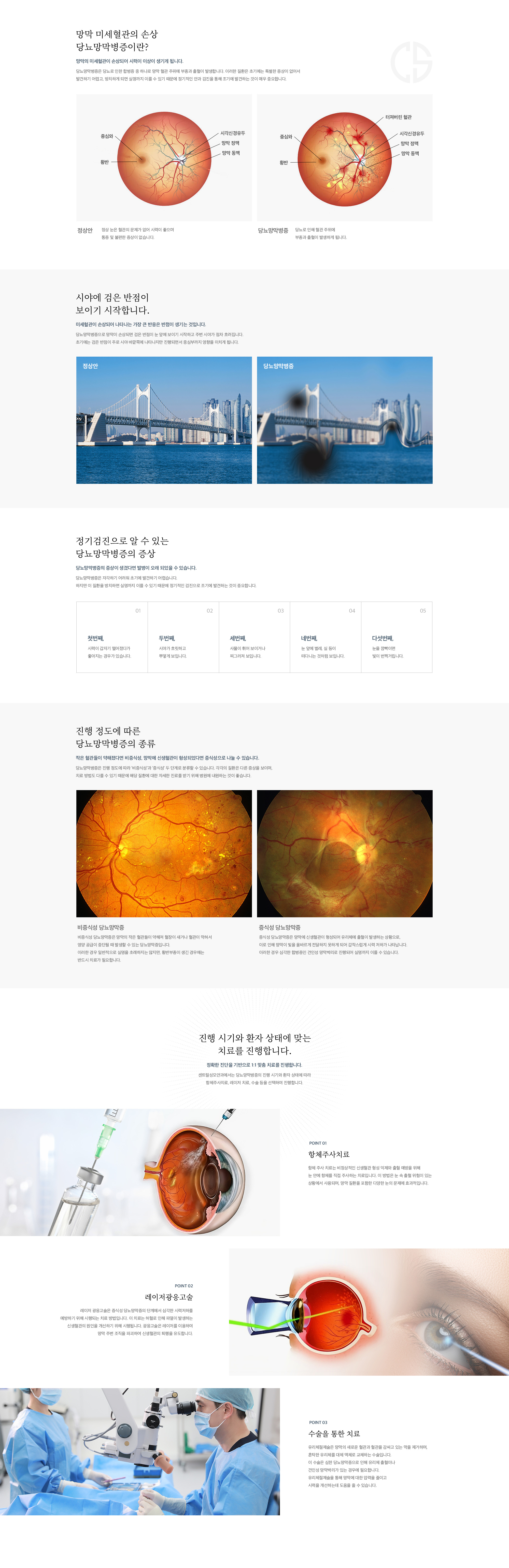 당뇨망막병증