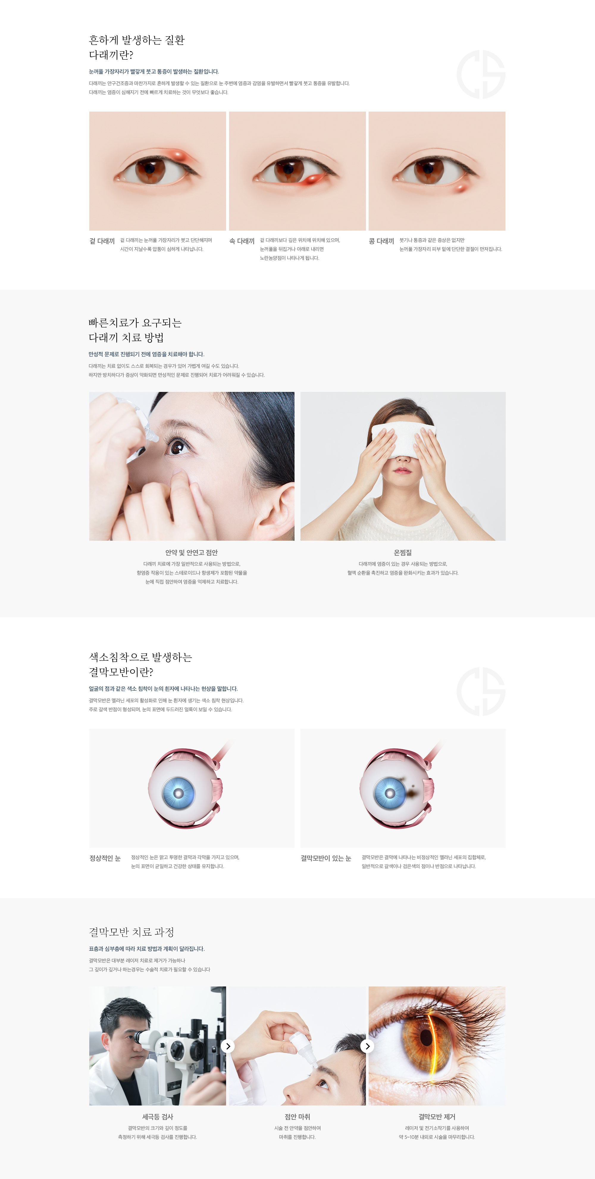 다래끼, 점, 양성 종양