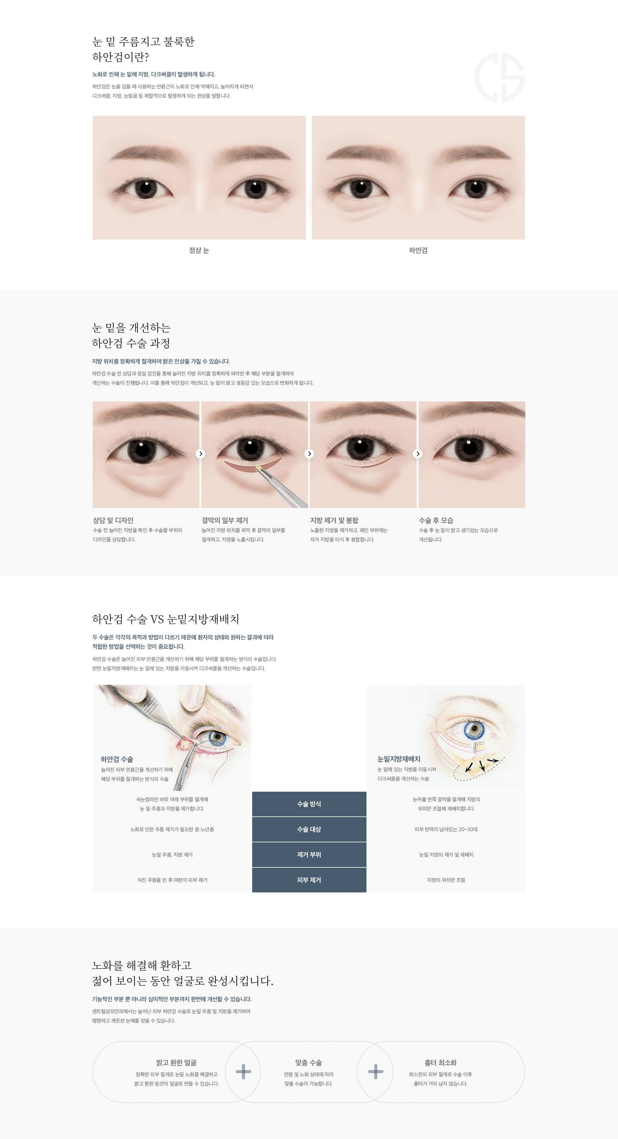 하안검 수술