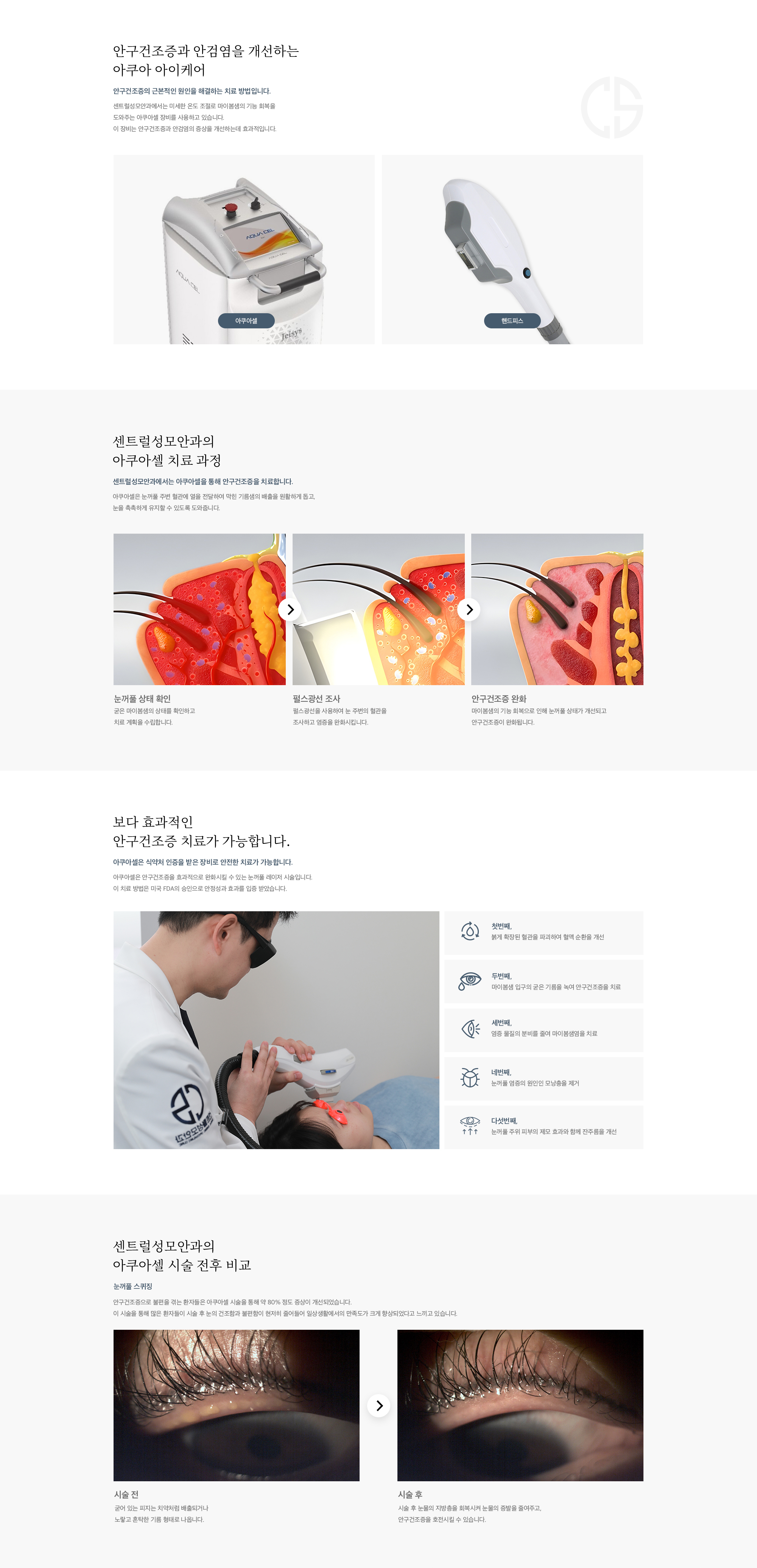 아쿠아 아이케어